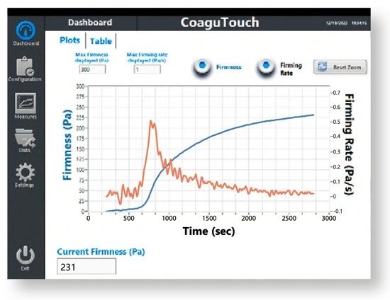 Visualização dos parâmetros de coagulação na tela táctil do equipamento CoaguSensTM. Firmeza de gel (linha azul) medida em Pa (pascal) e Reatividade da Coagulação (linha laranja) medida em Pa/s (Pascal por segundo).